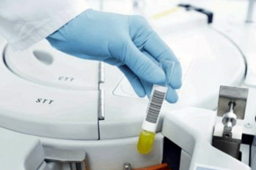 【香港时代医疗化验所】怀孕两个月了内裤发黄有异味怎么回事,香港验血3800贵