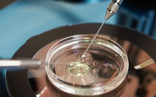 血送去香港验血当天出了结果,男的婚前检查会检查艾滋病吗