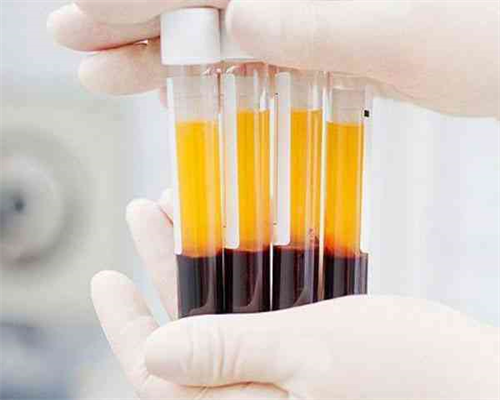 香港查男女几周可以,分享我是怎么成功验血如,香港验血时间不够