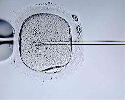 宫颈糜烂发病是什么状况(宫颈糜烂影响怀孕吗)~代怀助孕机构