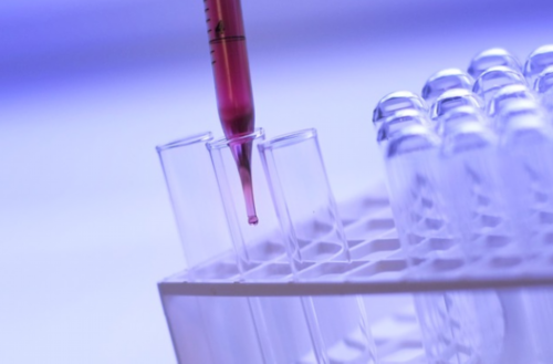 胎位rsp是什么意思啊,到香港验血测性别要空腹吗