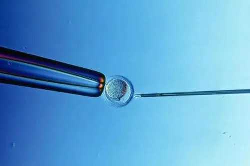 导致试管婴儿失败的原因有哪些？