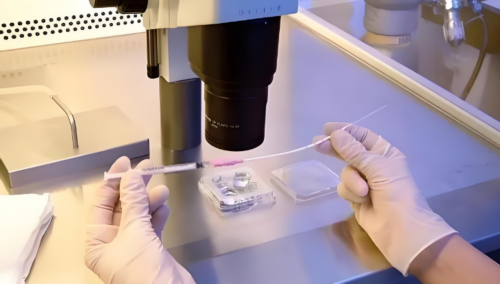 三代试管婴儿移植后为什么拉肚子?~代怀男孩