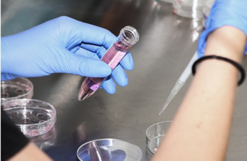 【香港时代医疗化验所】怀孕能不能吃可乐鸡翅,三十四天香港验血