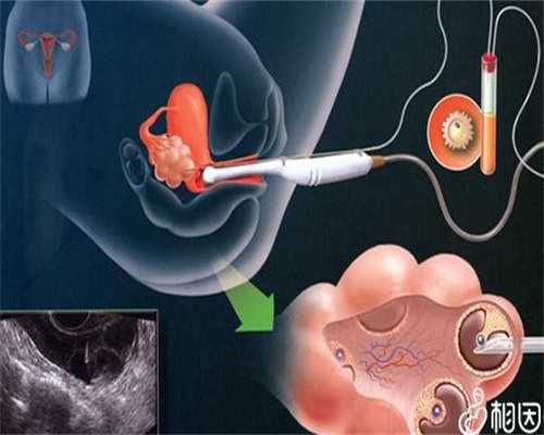 广州哪里有查胎儿性别_(给想去的姐妹一个参考,香港验血检查最权威的医院