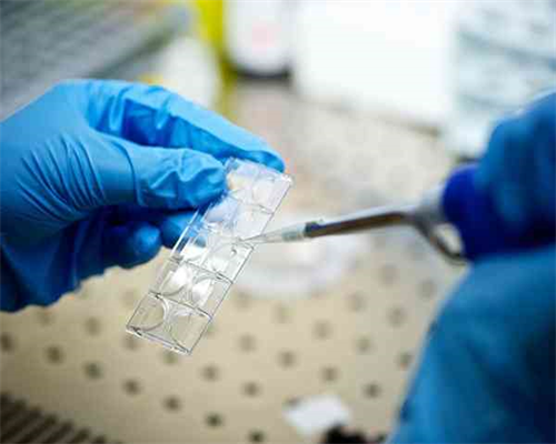 烟头亲子鉴定最快多久可以出结果,香港验血鉴定男女价格多少钱