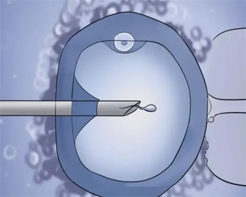 宫角妊娠的症状