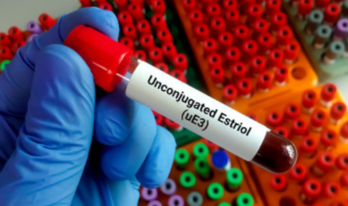 怀孕想验血查男女什么条件准确率百分百_想去验 两次验血测男女结果不一样准