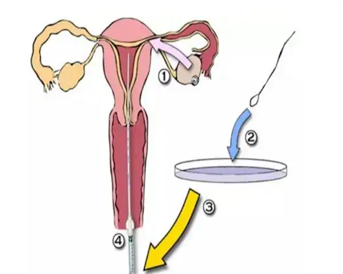 【香港时代医疗化验所】孕39周拉肚子跟水一样怎么回事,香港验血邮寄百世快递
