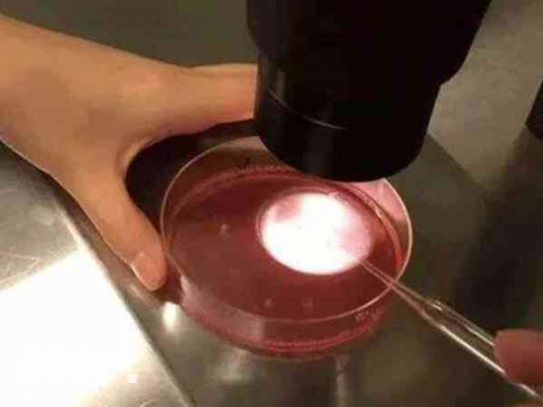 香港验血经验之谈——最高准确率的医院分享给,怀孕初期多久香港验血