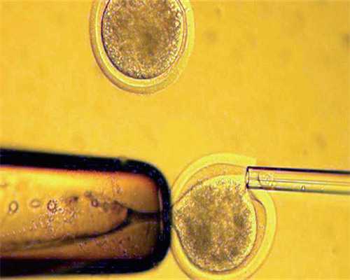 受精后多久能测出怀孕,香港验血当天出来吗