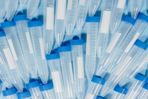 未满35岁,可以做无创产前检测吗?,孕妇香港验血10周