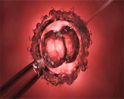 怀孕多久做彩超?