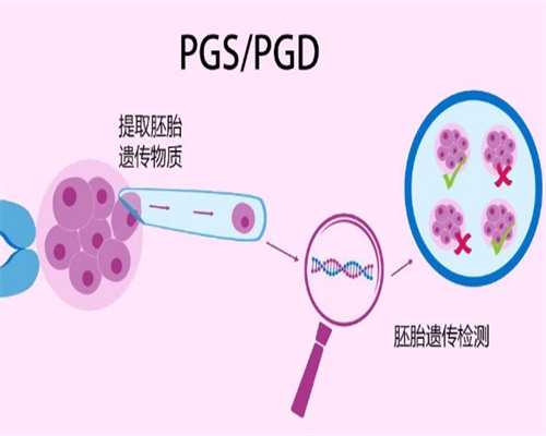 孕期乳房疼痛要怎么应对~供卵自怀三代