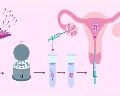 广州十佳试管医院排名(试管美国排名)