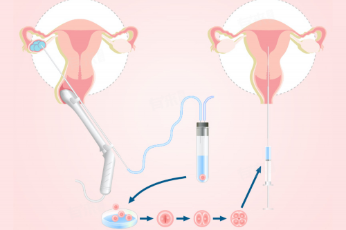 怀孕的呕吐和肠胃炎,怀孕的呕吐是什么感觉?~供卵助孕男孩