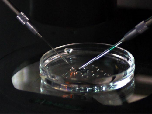 去香港验血查性别为什么需要提供B超单?,香港几周验血最好