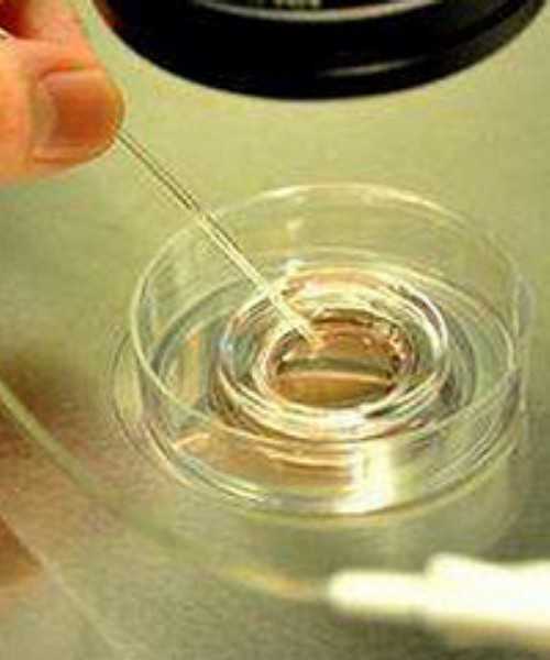 香港化验血检查男女结果,香港验性别要预约吗,攻略及流程条件分享 验血检测男