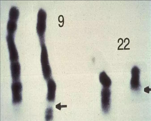香港验血结果到底能信吗,孕早期孕酮低吃燕窝有帮助吗