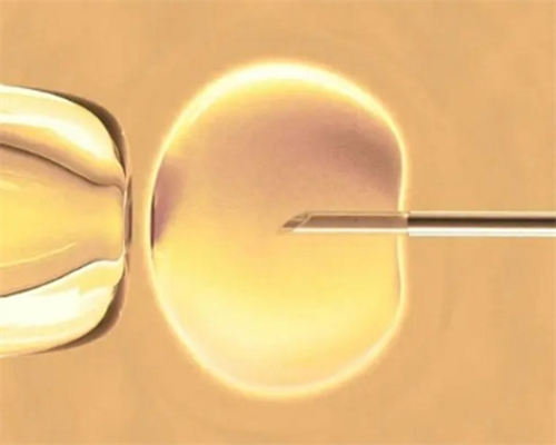 怎样做胎儿性别男女鉴定,香港验血几周才比较准确率