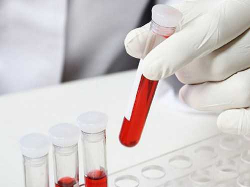 做了后多长时间知道怀孕——{检测xy当属准确度,香港邮寄验血3200靠谱吗