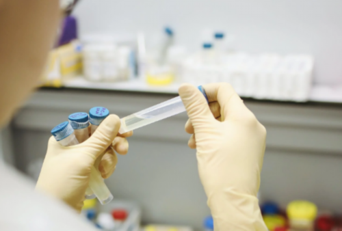 植发前为什么要验血,香港验血邮寄血邮费