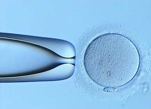 冻胚胎移植和鲜胚胎移植_移植鲜胚囊胚冻胚~代怀男宝