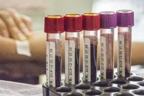 香港现代验血复查
 香港验血报告单真假图，成功的验血经历宝妈可,7周香港验