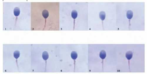 试管婴儿鲜胚什么等级的最优质最适合移植？~供卵包生男孩