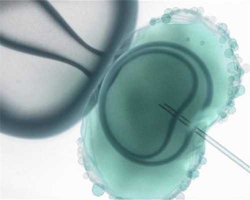 西安代孕包男孩公司,西安人类精子库在哪里,西安人类精子库具体在西安哪个医