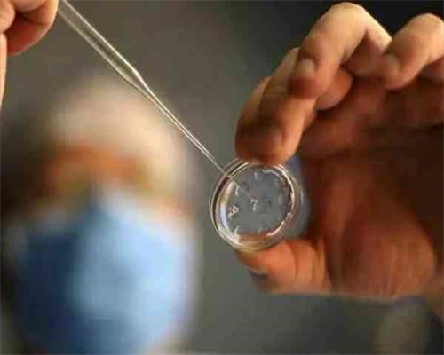 三年前输过血会影响香港验血结果么,【香港时代医疗化验所】唐筛结果21三体正