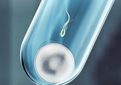 孕妇第一次做b超需要空腹吗