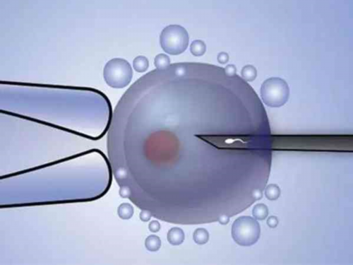 【真相曝光】国内验血1000元查男女,去香港新安诊所验血