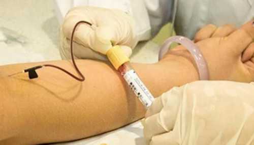 美国试管婴儿长短方案有哪些区别呢