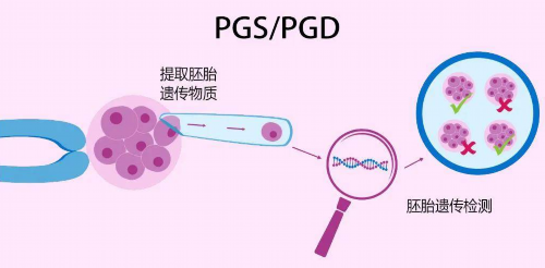 4bb囊胚着床成功表现,4bb囊胚移植着床反应有哪些?~代生子价格