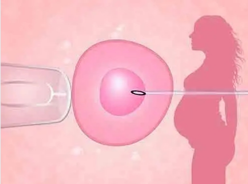 ,去香港验血查胎儿性别要空腹抽血吗